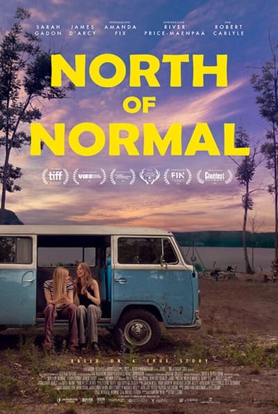 Au nord de la norme
